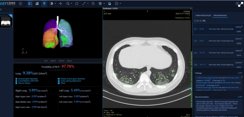 2020-04-08_9-47-16 2020 04 08 9 47 16 Intel อินเทลทุ่ม 50 ล้านดอลลาร์สหรัฐฯ ริเริ่มเทคโนโลยีรับมือโรคระบาดเพื่อต่อสู้กับโคโรน่าไวรัสหรือโควิด 19